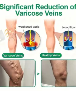 Clearena® VeinTarget Microneedle Patch Once Daily, Visible Results in 7 Days