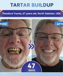 𝐂𝐥𝐞𝐚𝐫𝐞𝐧𝐚® Tideglusib Fast‑Dissolving Tooth & Gum Repair Oral Strips