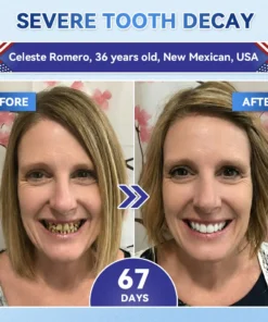 𝐂𝐥𝐞𝐚𝐫𝐞𝐧𝐚® Tideglusib Fast‑Dissolving Tooth & Gum Repair Oral Strips