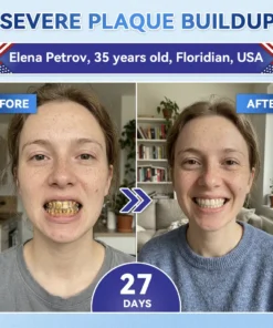 𝐂𝐥𝐞𝐚𝐫𝐞𝐧𝐚® Tideglusib Fast‑Dissolving Tooth & Gum Repair Oral Strips