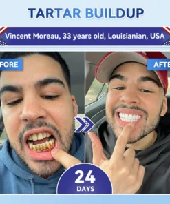 𝐂𝐥𝐞𝐚𝐫𝐞𝐧𝐚® Tideglusib Fast‑Dissolving Tooth & Gum Repair Oral Strips