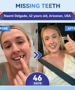 𝐂𝐥𝐞𝐚𝐫𝐞𝐧𝐚® Tideglusib Fast‑Dissolving Tooth & Gum Repair Oral Strips